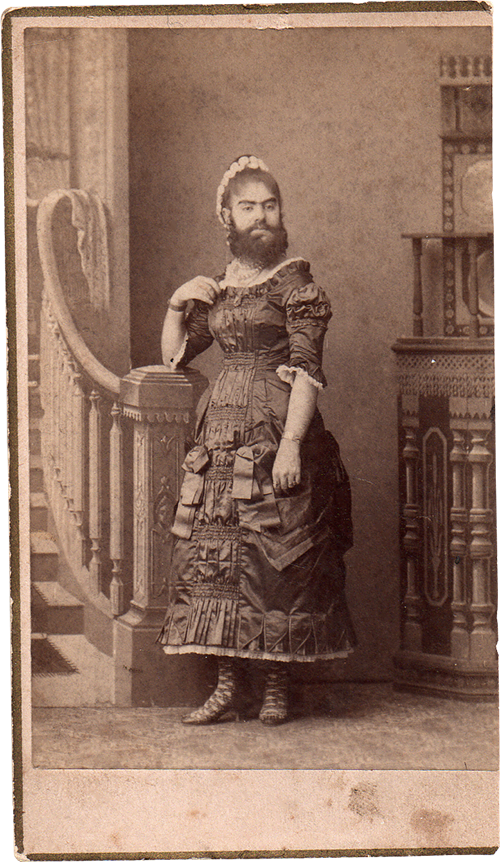 bearded lady annie jones